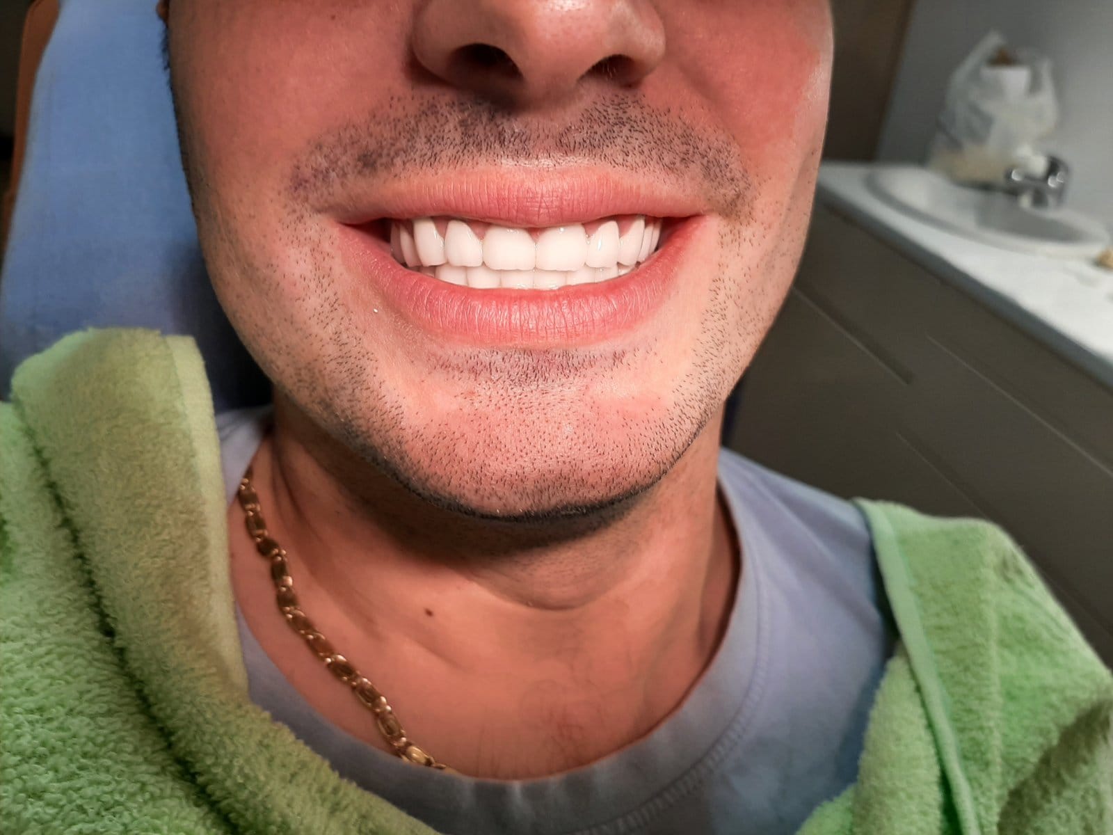 hOLIVUDSKI OSMEH Holivud smile<br />